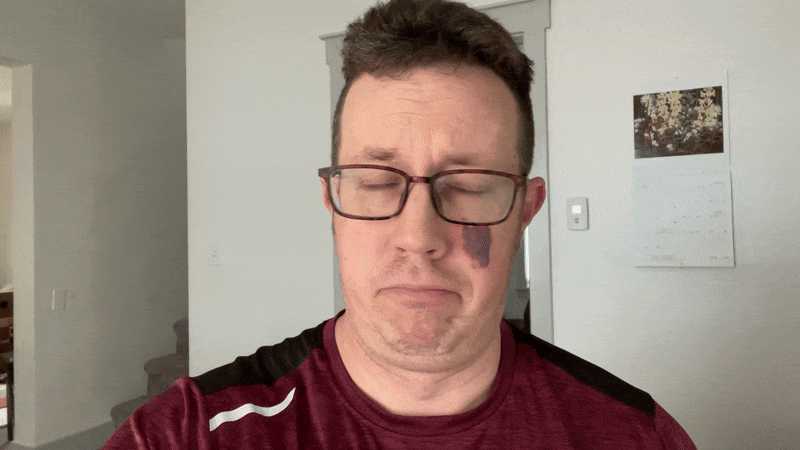 Pete shaking his head